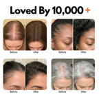Koreas #1 Hair Growth Serum