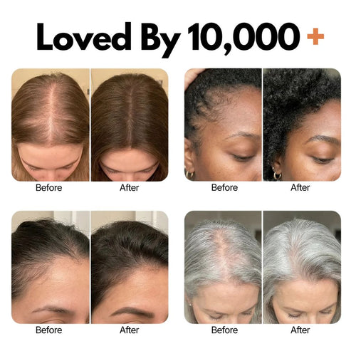 Growturn Hair Serum with Brush
