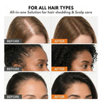 Koreas #1 Hair Growth Serum